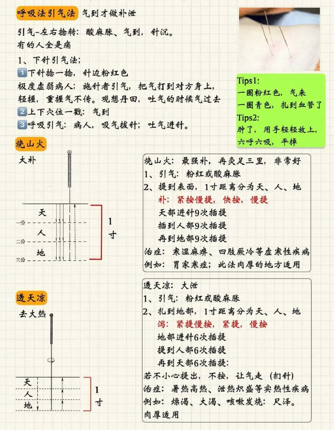针刺手法1