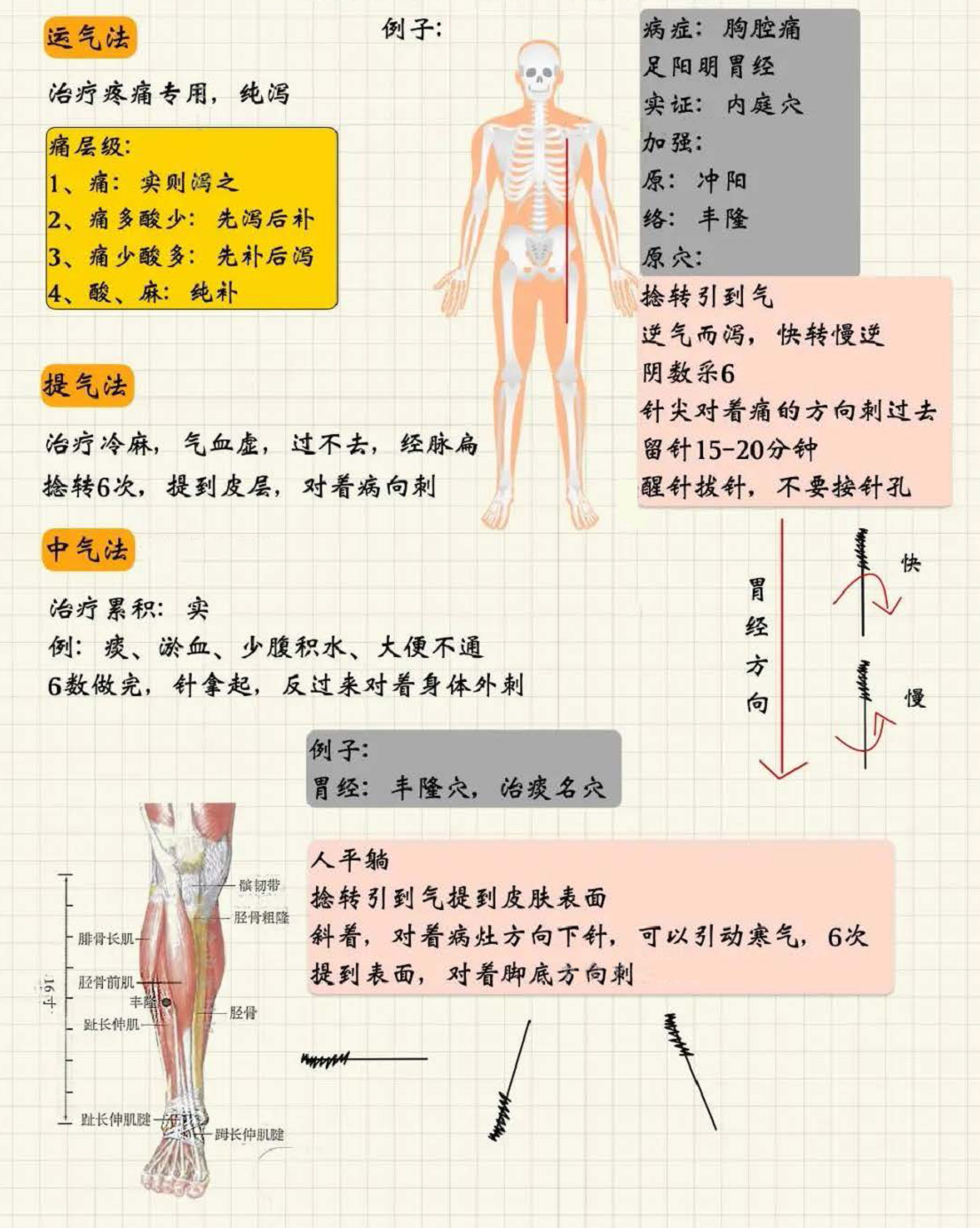 针刺手法3